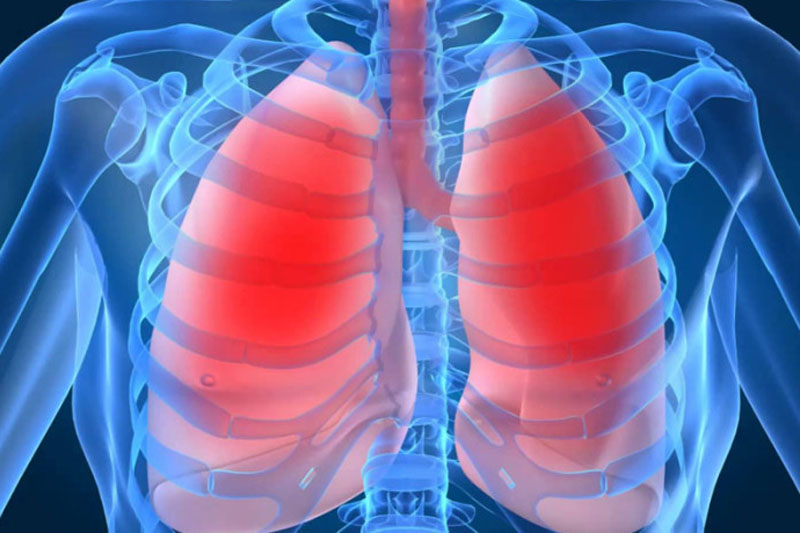 PULMONES.jpg