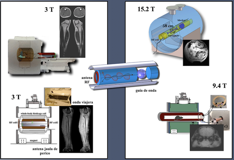 IMAGENOLOGIA POR RESONANCIA.png
