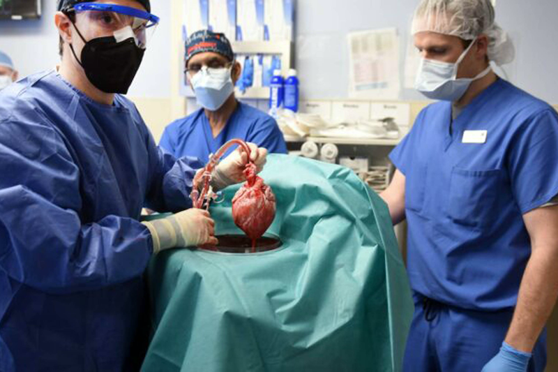 medicos cirujanos trasplante de corazon.png